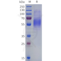 Human CDCP1(30-368) Protein, His Tag – Figure 1 of 1