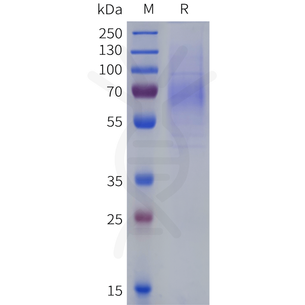 Human CDCP1(30-430) Protein, His Tag – Figure 1 of 1