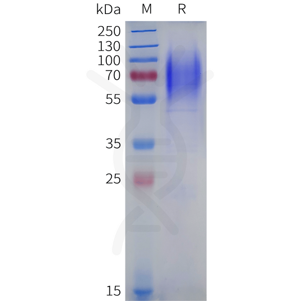 Human LAMP1 Protein, His Tag – Figure 1 of 1