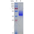 Human GPR45 Protein, hFc Tag – Figure 1 of 1