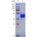 Human ADRB2 Protein, hFc Tag – Figure 1 of 1