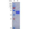 Human AVPR2 Protein, hFc Tag – Figure 1 of 1