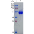 Human HTR2A Protein, hFc Tag – Figure 1 of 1