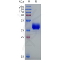 Human HTR6 Protein, hFc Tag – Figure 1 of 1