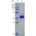 Human OR1J4 Protein, hFc Tag – Figure 1 of 1