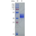 Human OR2T12 Protein, hFc Tag – Figure 1 of 1