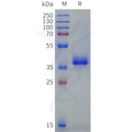 Human OR6C70 Protein, hFc Tag – Figure 1 of 1