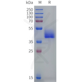 Human P2RY12 Protein, hFc Tag – Figure 1 of 1