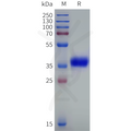 Human RGR Protein, hFc Tag – Figure 1 of 1