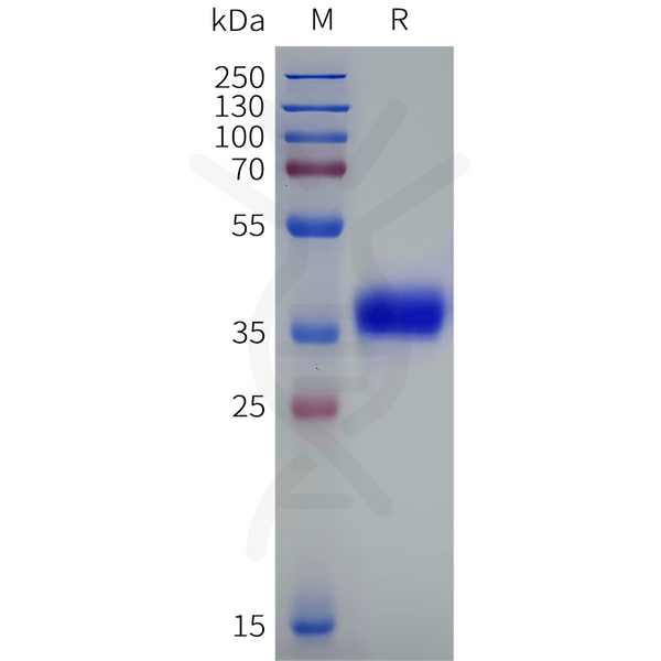 Human RGR Protein, hFc Tag – Figure 1 of 1