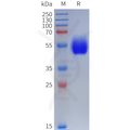 Human CALCR Protein, hFc Tag – Figure 1 of 1