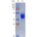 Human DRD3 Protein, hFc Tag – Figure 1 of 1