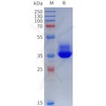 Human DRD4 Protein, hFc Tag – Figure 1 of 1
