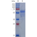 Human EDNRA Protein, hFc Tag – Figure 1 of 1