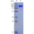 Human IL6ST Protein, His Tag – Figure 1 of 1