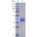 Human GPR101 Protein, hFc Tag – Figure 1 of 1