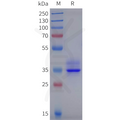 Human HTR4 Protein, hFc Tag – Figure 1 of 1