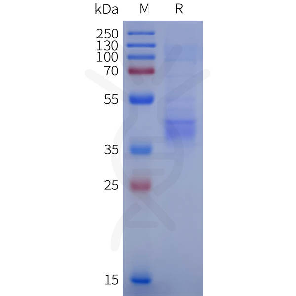 Human FAM171A2 Protein, His Tag – Figure 1 of 1