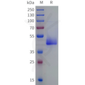 Human CD3D-knob and CD3E-Hole Heterodimer Protein, His Tag and Twin Strep tag – Figure 1 of 1