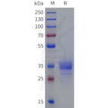 Human OR10J5 Protein, hFc Tag – Figure 1 of 1