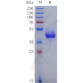 Human GPR17 Protein, hFc Tag – Figure 1 of 1