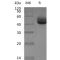 Human IL-4 (C-Fc) Protein – Figure 1 of 1