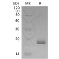 Human IL-28B Protein – Figure 1 of 1