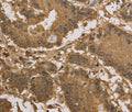 KDM5B Polyclonal Antibody – Figure 1 of 2