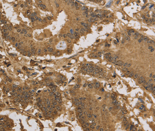 KDM5B Polyclonal Antibody – Figure 1 of 2
