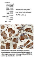 Anti-PMVK Antibody – Figure 1 of 1