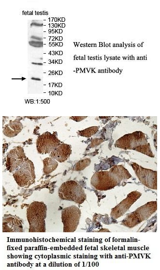 Anti-PMVK Antibody – Figure 1 of 1