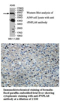 Anti-PNPLA8 Antibody – Figure 1 of 1