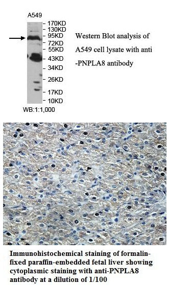 Anti-PNPLA8 Antibody – Figure 1 of 1