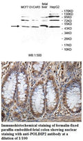 Anti-POLDIP2 Antibody – Figure 1 of 1