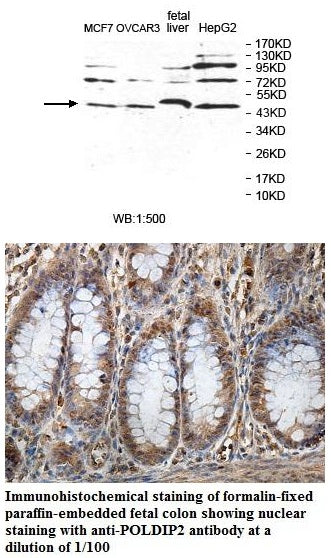 Anti-POLDIP2 Antibody – Figure 1 of 1