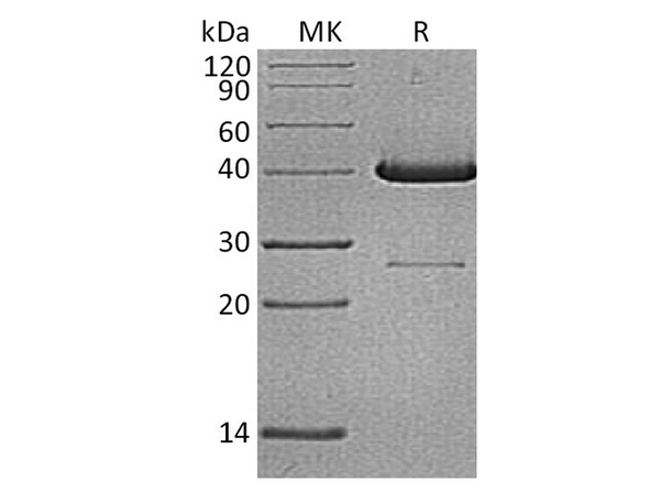 Recombinant Human UBE2D1 Protein (GST Tag) – Figure 1 of 2