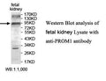 Anti-PROM1 Antibody – Figure 1 of 1