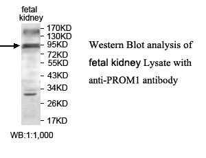 Anti-PROM1 Antibody – Figure 1 of 1