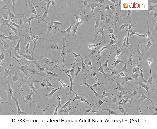 Immortalized Human Adult Brain Astrocytes (AST-1) | Applied Biological Materials (abm)