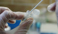 PureBind Swab DNA Isolation Kit – Figure 1 of 1