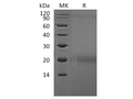 Recombinant Human CTLA4 Protein (Flag Tag) – Figure 1 of 2