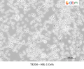 HBL-1 Cells – Figure 1 of 1