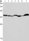 GOT2 Polyclonal Antibody – Figure 1 of 4