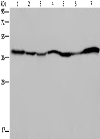 GOT2 Polyclonal Antibody – Figure 1 of 4