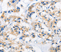 HK1 Polyclonal Antibody – Figure 1 of 2