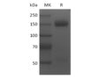 Recombinant Human BCMA/TNFRSF17 (N-6His-Flag) – Figure 1 of 2