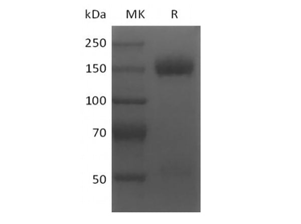 Recombinant Human BCMA/TNFRSF17 (N-6His-Flag) – Figure 1 of 2
