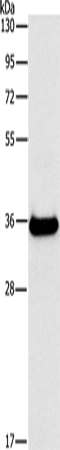 FGL1 Polyclonal Antibody – Figure 1 of 3