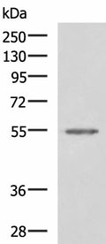 SLC16A1 Polyclonal Antibody – Figure 1 of 4