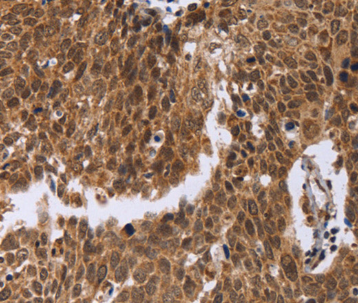 ERCC6L Polyclonal Antibody – Figure 1 of 3